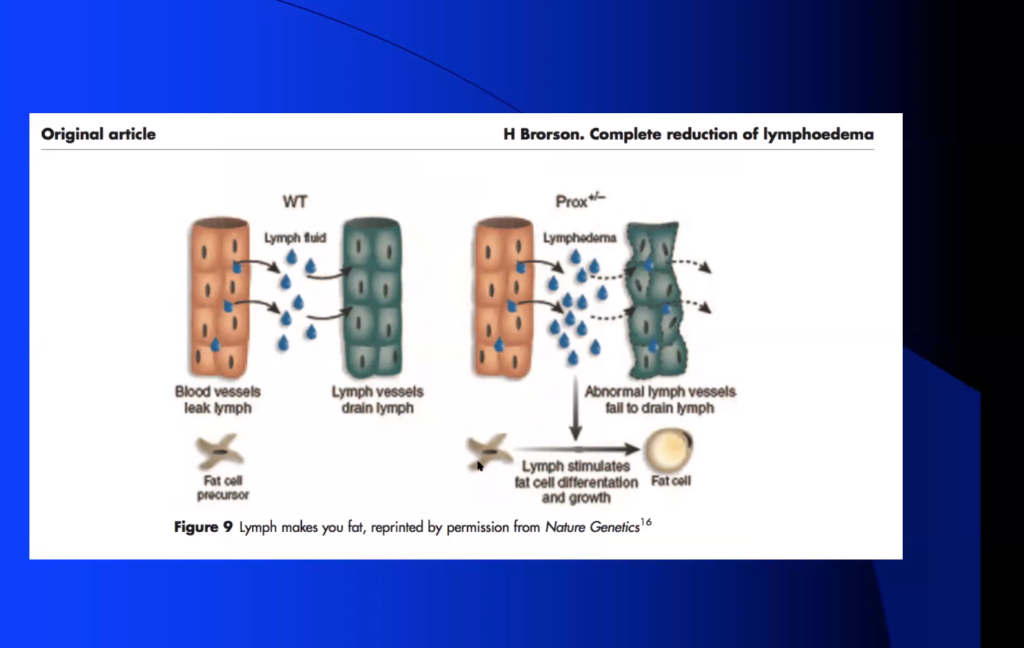 Lymph Makes you Fat: Brorson Nature Genetics